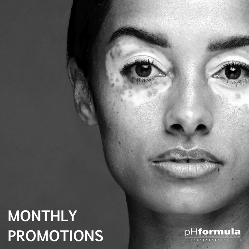 Monthly Promotions